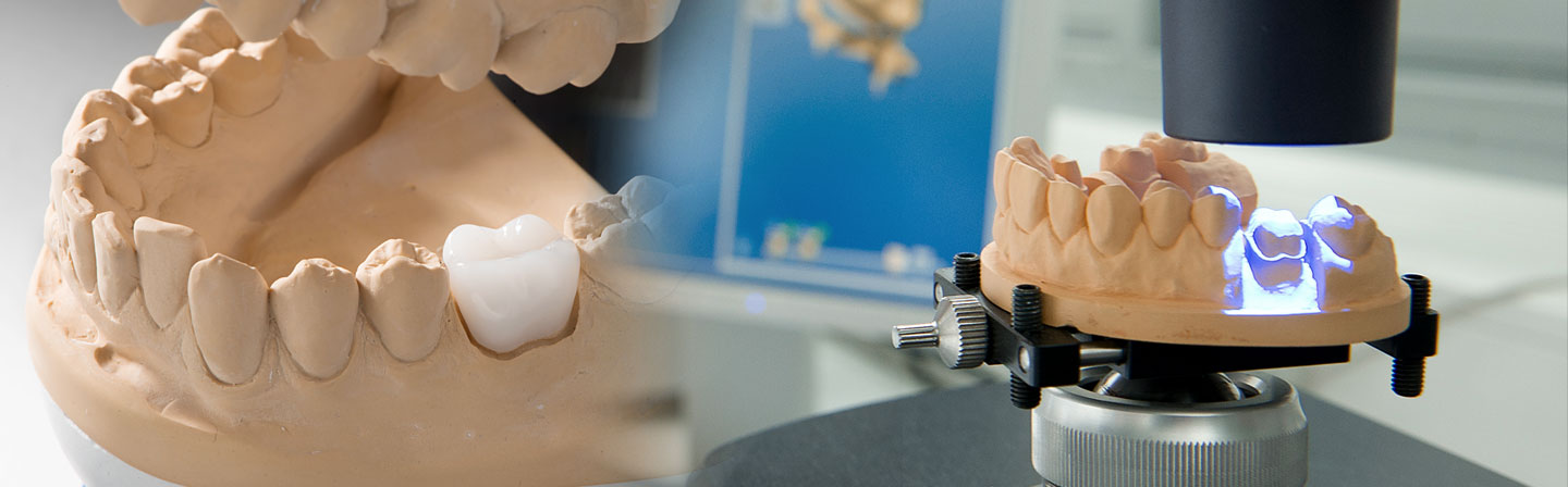 ORMOCER® for dental application